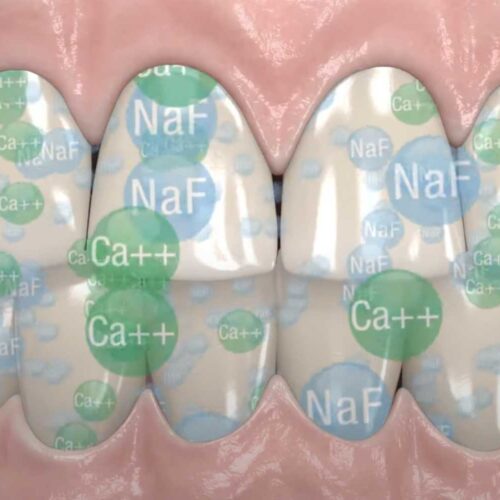 remineralizacion-fluoruro-calcio-proteccion-opalescence-ultradent