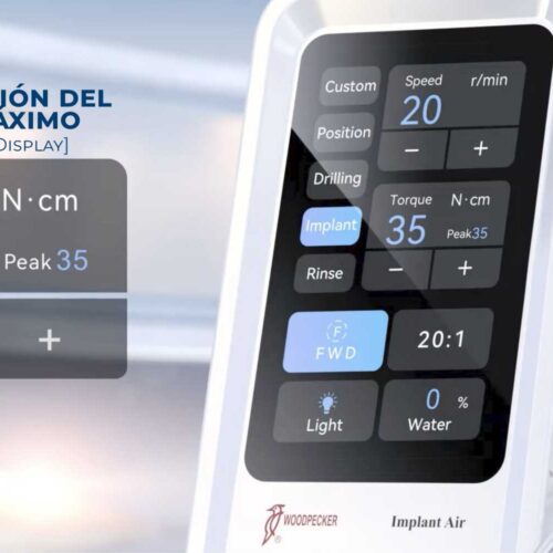 Peak Value Display Woodpecker